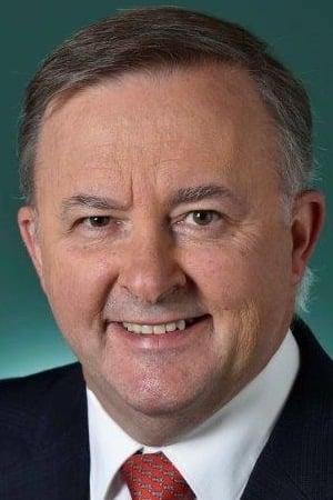 Anthony Albanese poster