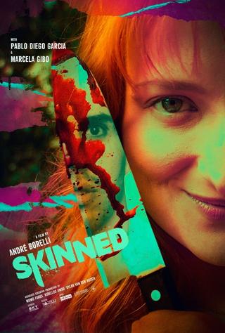 Skinned poster