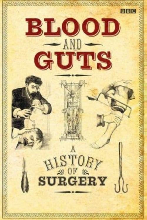 Blood and Guts: A History of Surgery poster