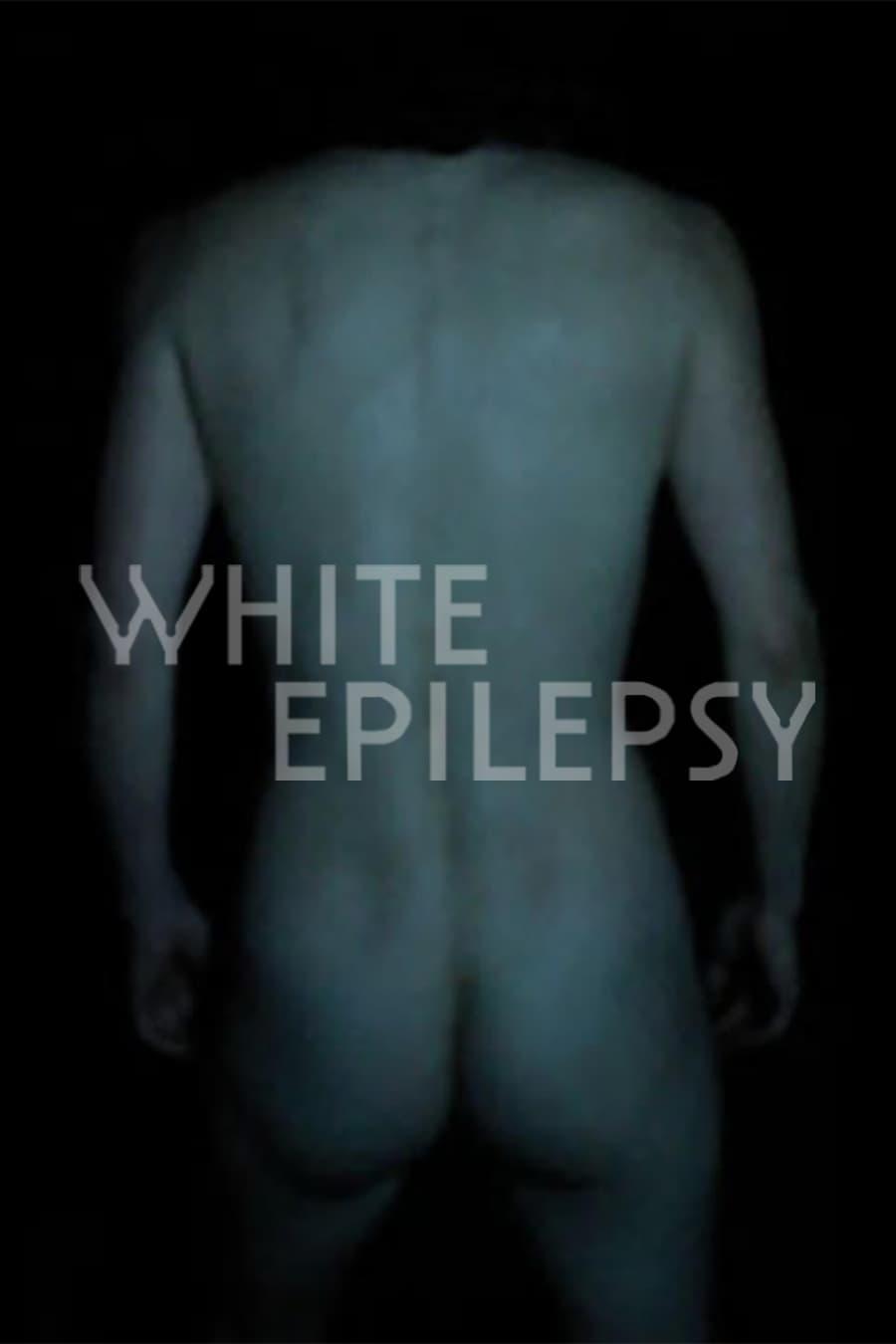 White Epilepsy poster