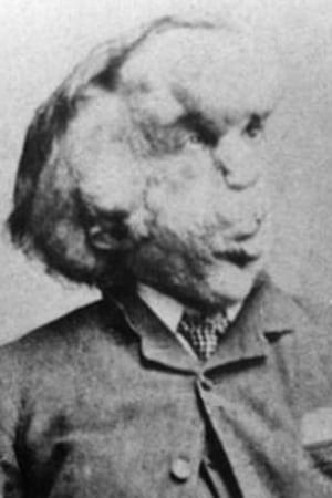 Joseph Merrick poster