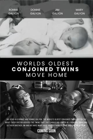 World's Oldest Conjoined Twins Move Home poster