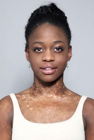 Michaela Deprince pic