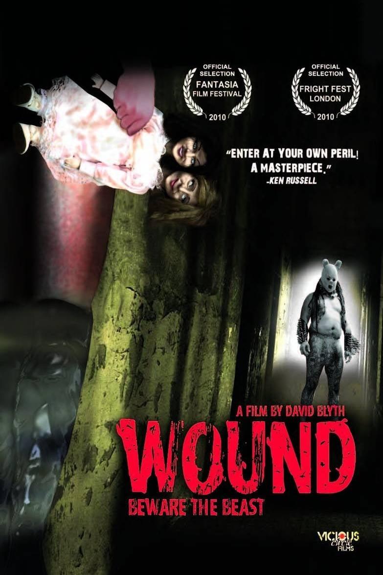 Wound poster