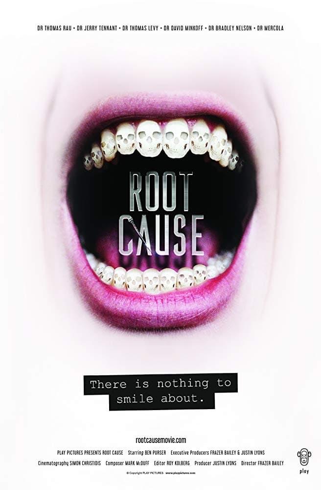 Root Cause poster