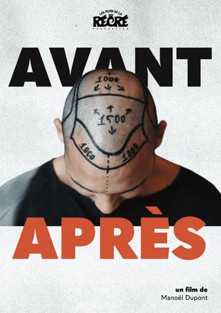 Avant/Après poster