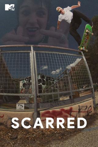 Scarred poster