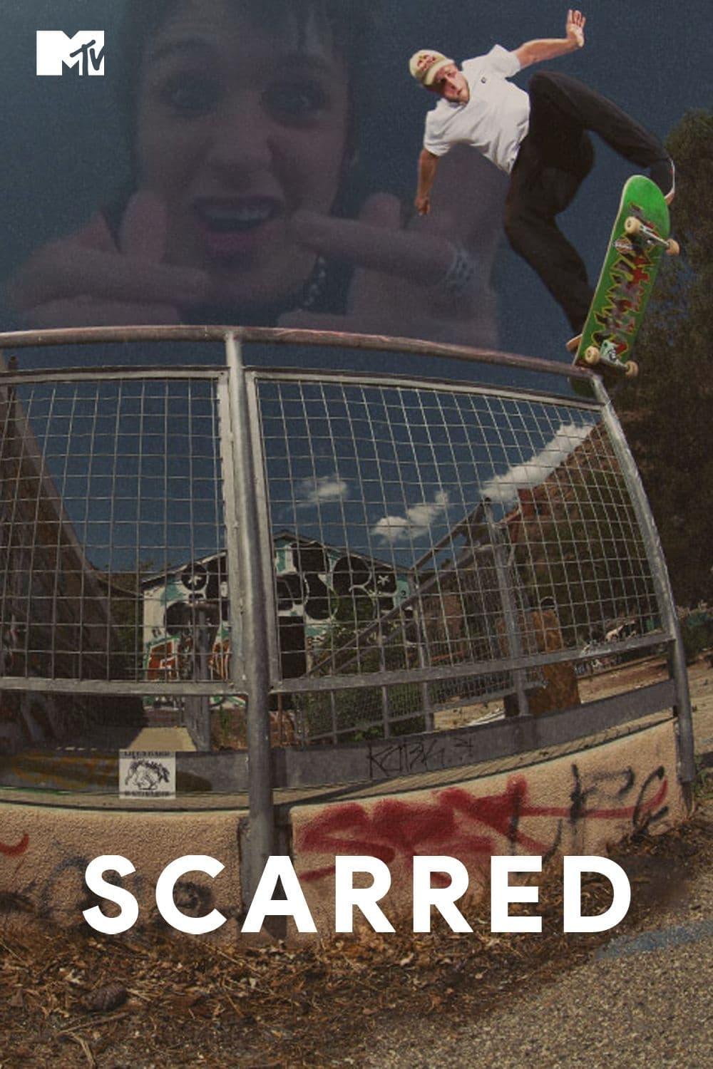 Scarred poster