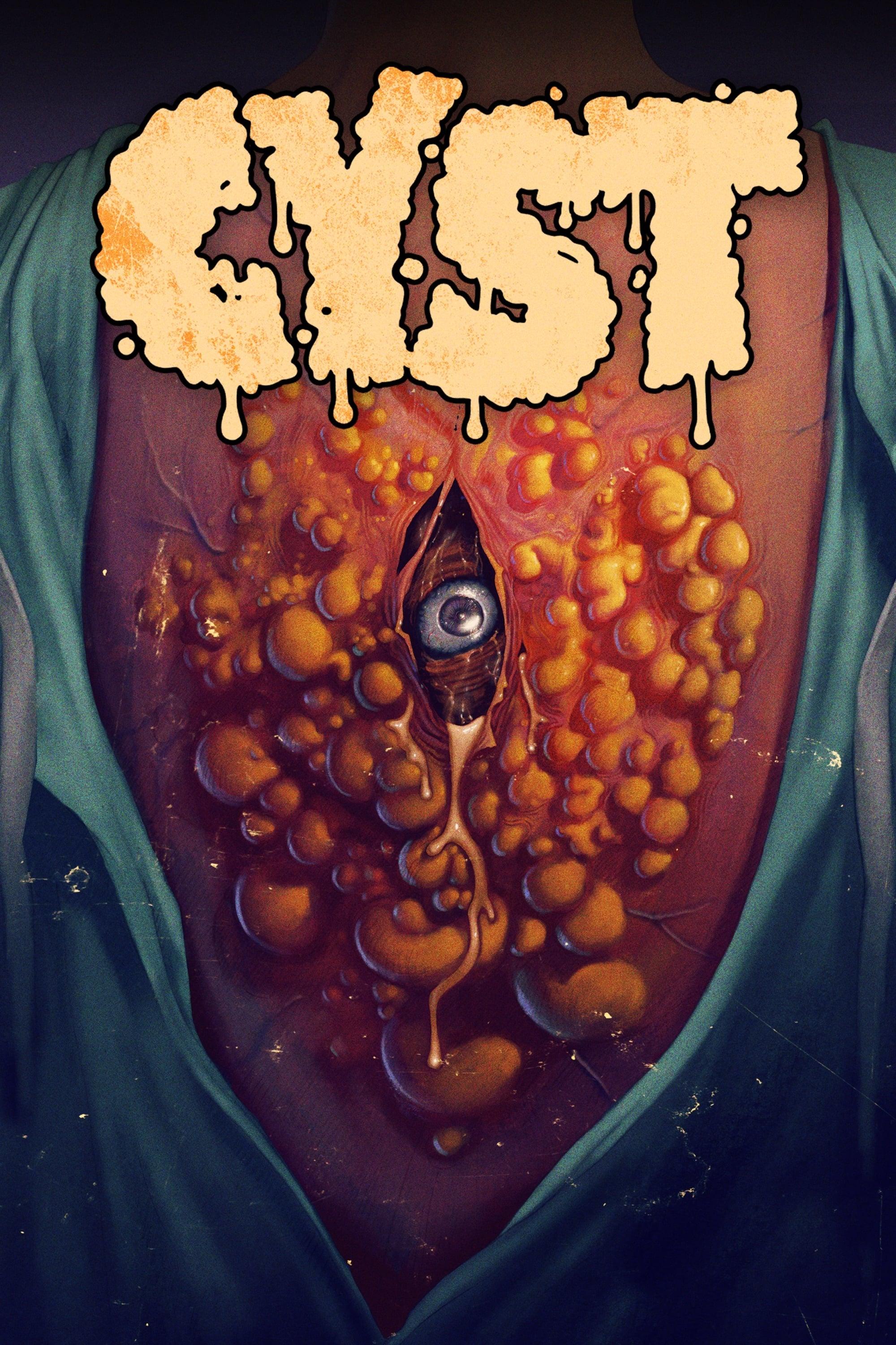 Cyst poster