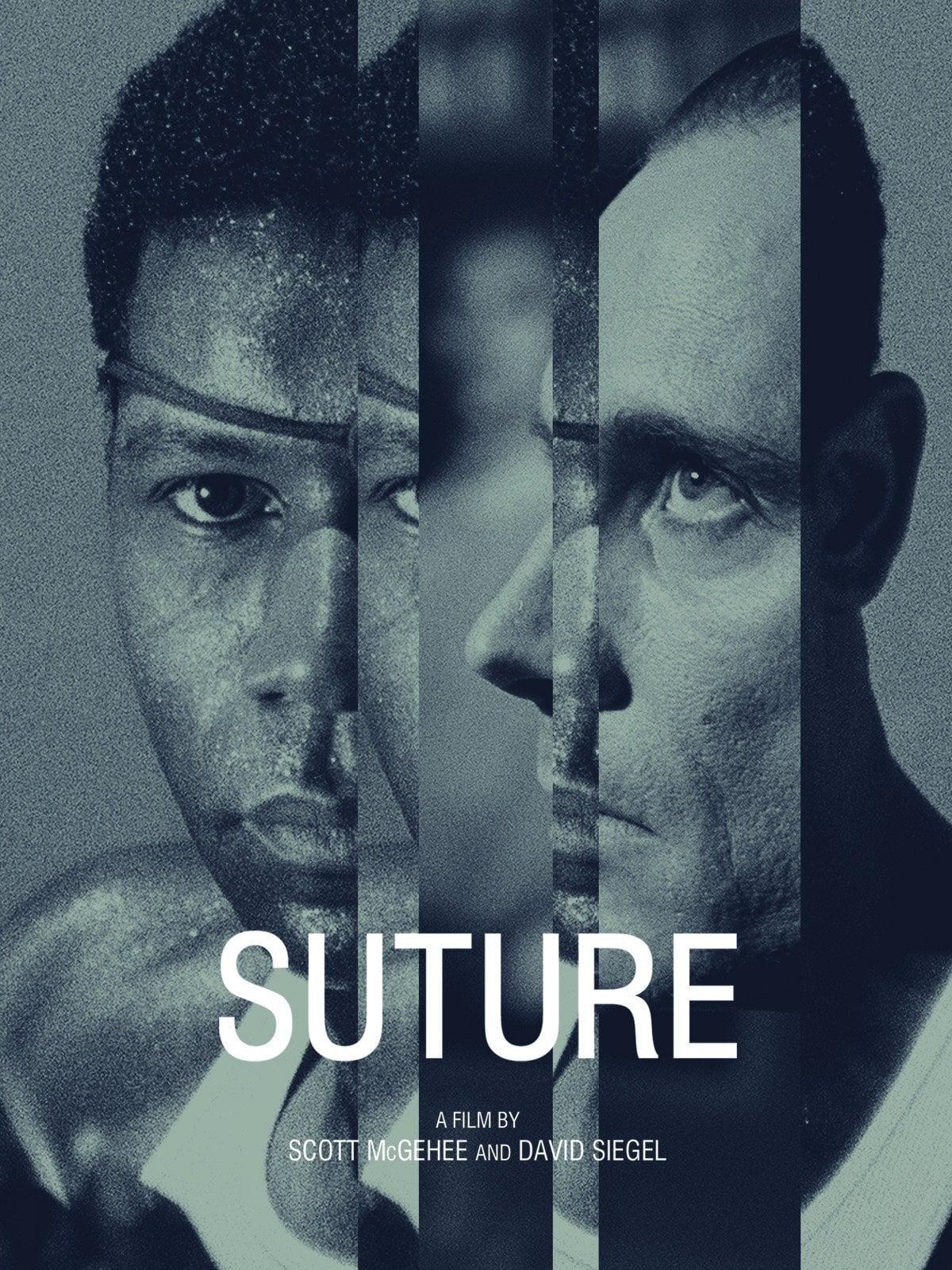 Suture poster