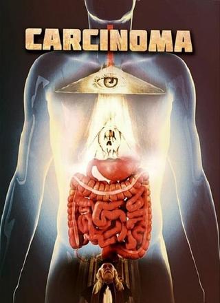 Carcinoma poster